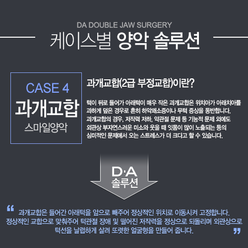 [DA성형외과 스마일양악수술]케이스별 양악솔루션을 소개합니다. 관련 이미지 4