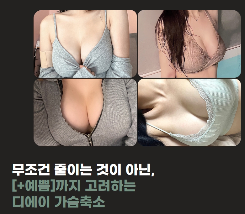 5 Things to Check Before Considering Breast Reduction Surgery Costs image 6
