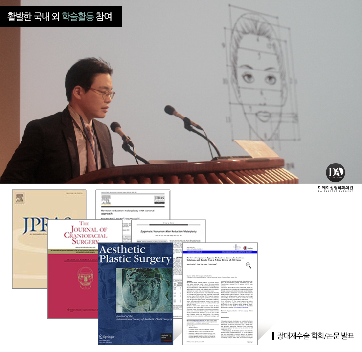 안면윤곽 재수술 체크리스트 관련 이미지 15