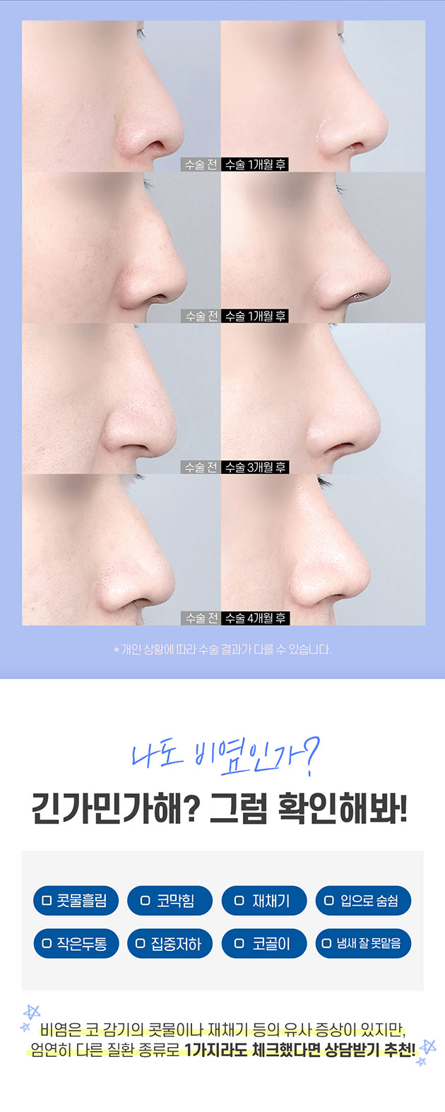 남자 기능코 수술 제대로 알고해야 관련 이미지 5