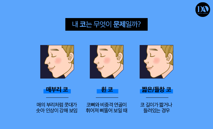 세련된 인상을 만드는 남자 코 성형 BEST 3 관련 이미지 3