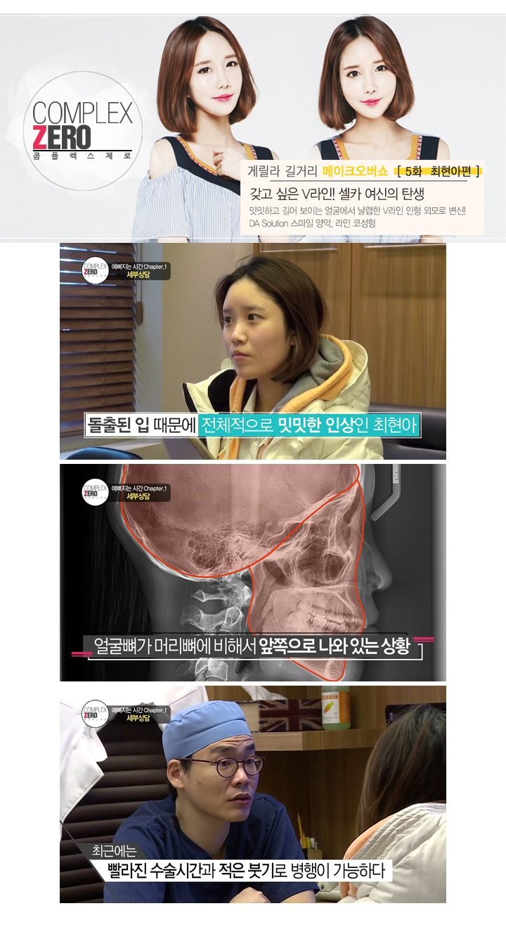 디에이성형외과 콤플렉스제로 5대 제로女 최현아편! 관련 이미지 5