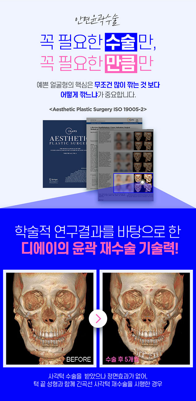 남자 윤곽 수술 알아볼 때 주의사항 관련 이미지 6