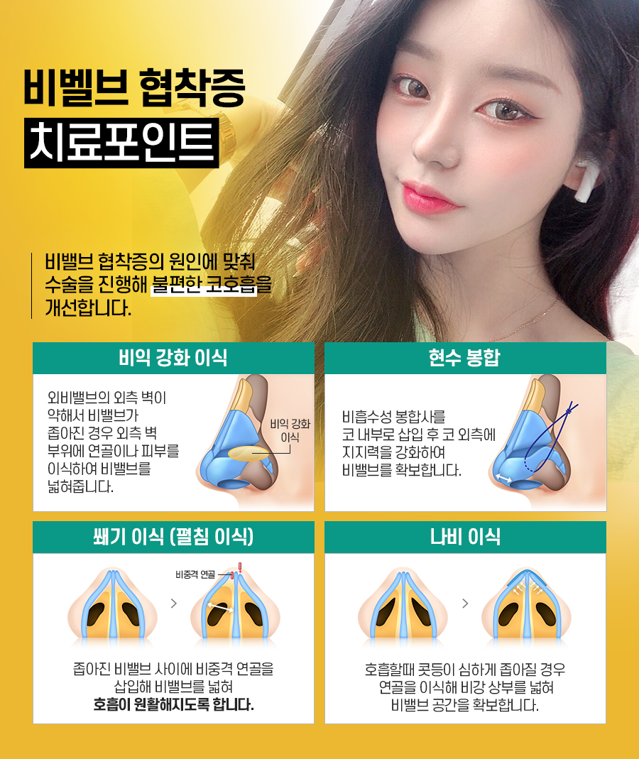 비염수술 코 내부의 구조적 문제를 해결해야 관련 이미지 8