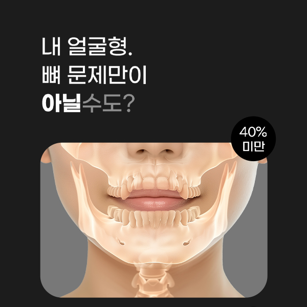 얼굴형 고민 끝! 연조직윤곽술로 균형 잡힌 인상 만들기 관련 이미지 3