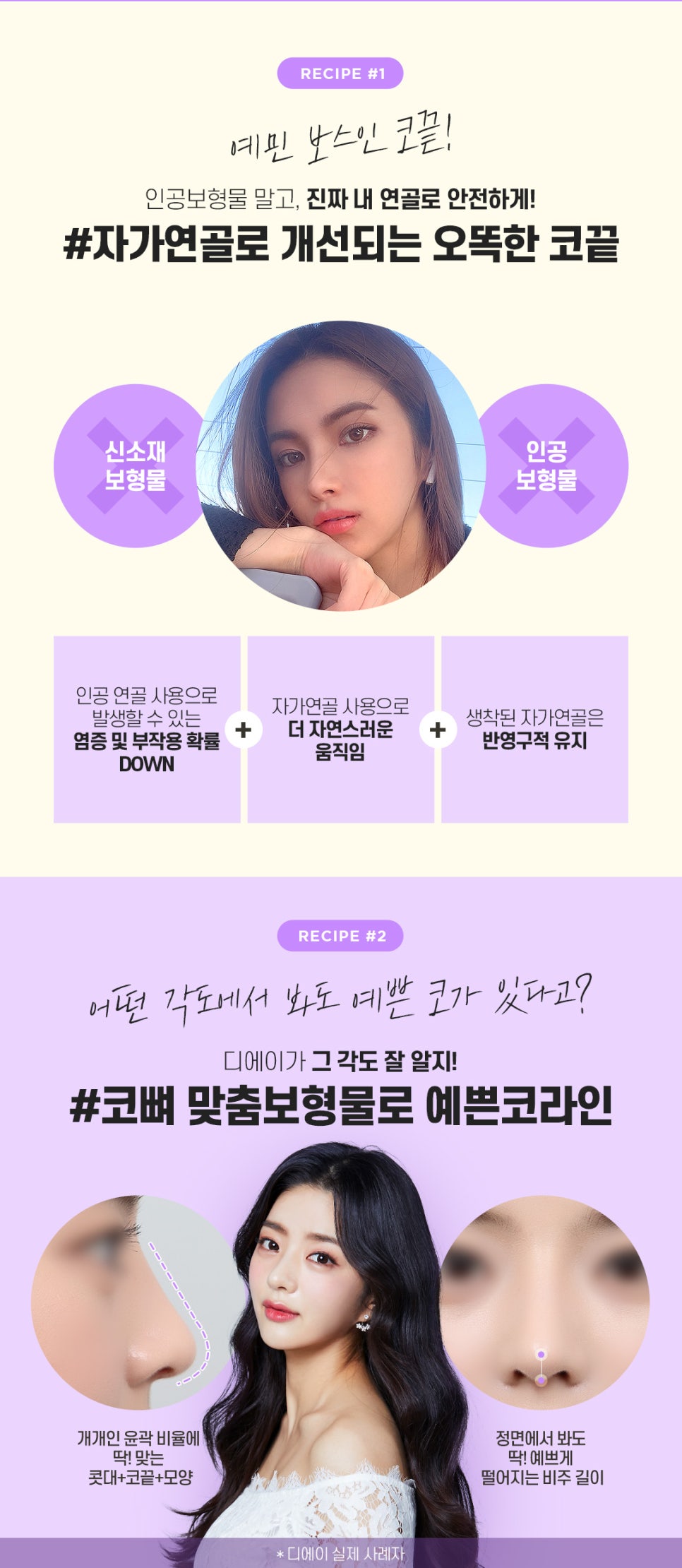 자가연골코성형 알아볼 때 주의사항 관련 이미지 4