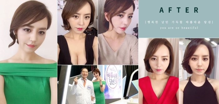 디에이성형외과와 함께한 두번째 주인공, 아름다운당신3 방혜정 관련 이미지 5