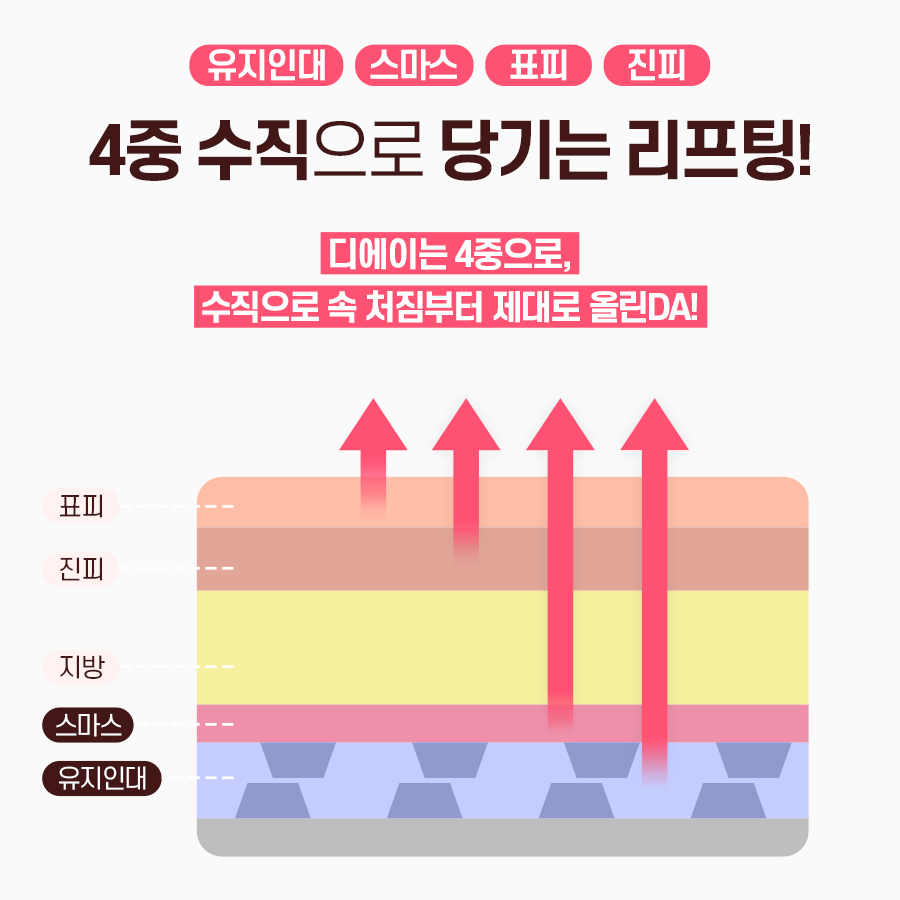 처진얼굴, 탄력개선에 효과적인 시술 방법 관련 이미지 6