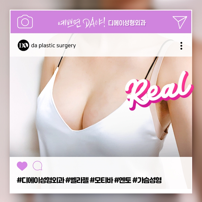 가슴성형 시작은 보형물 선택에서부터! 보형물 종류와 주의사항 관련 이미지 3