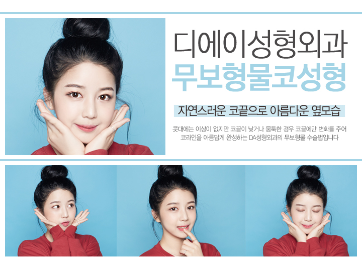무보형물코성형 디에이성형외과에서 완성 관련 이미지 2