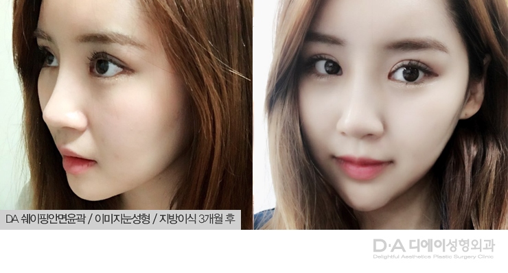 모델스토리 쉐이핑안면윤곽으로 청초한 분위기 여신 관련 이미지 4