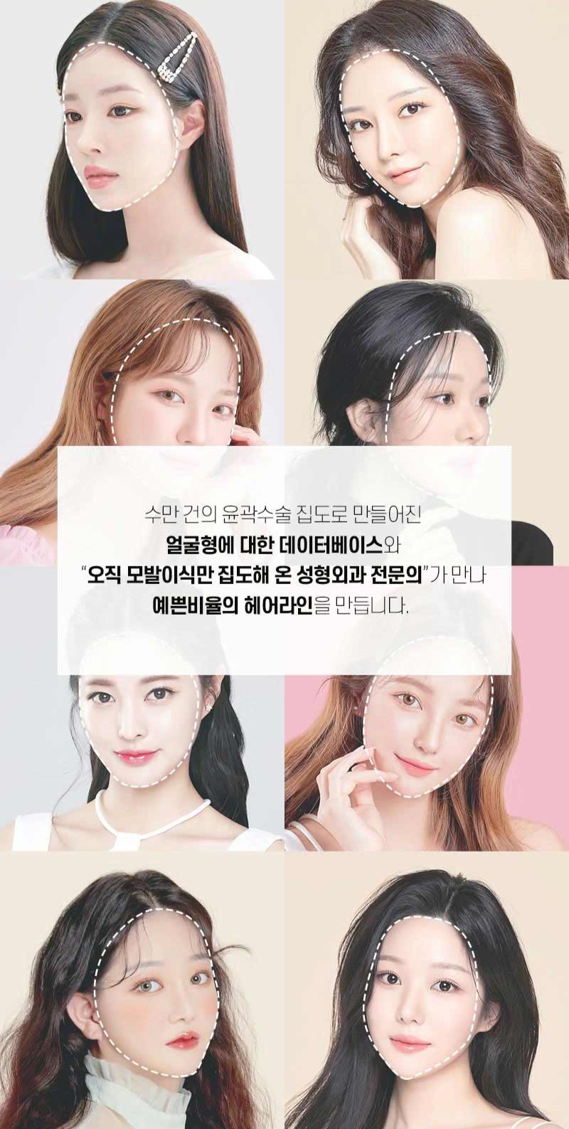 헤어라인 모발이식으로 인형외모갖기 관련 이미지 3