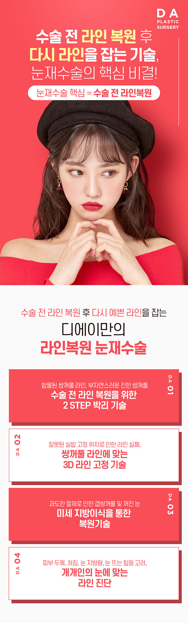 강남역 눈재수술 잘 하는 곳 관련 이미지 4