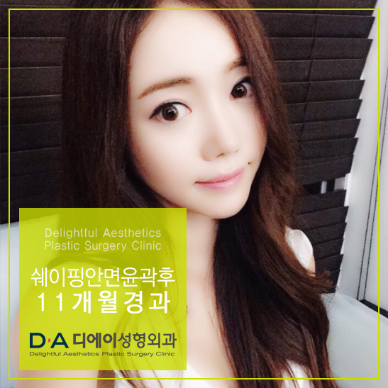 DA성형외과 쉐이핑안면윤곽수술로 매끈한 턱라인 완성! 관련 이미지 4