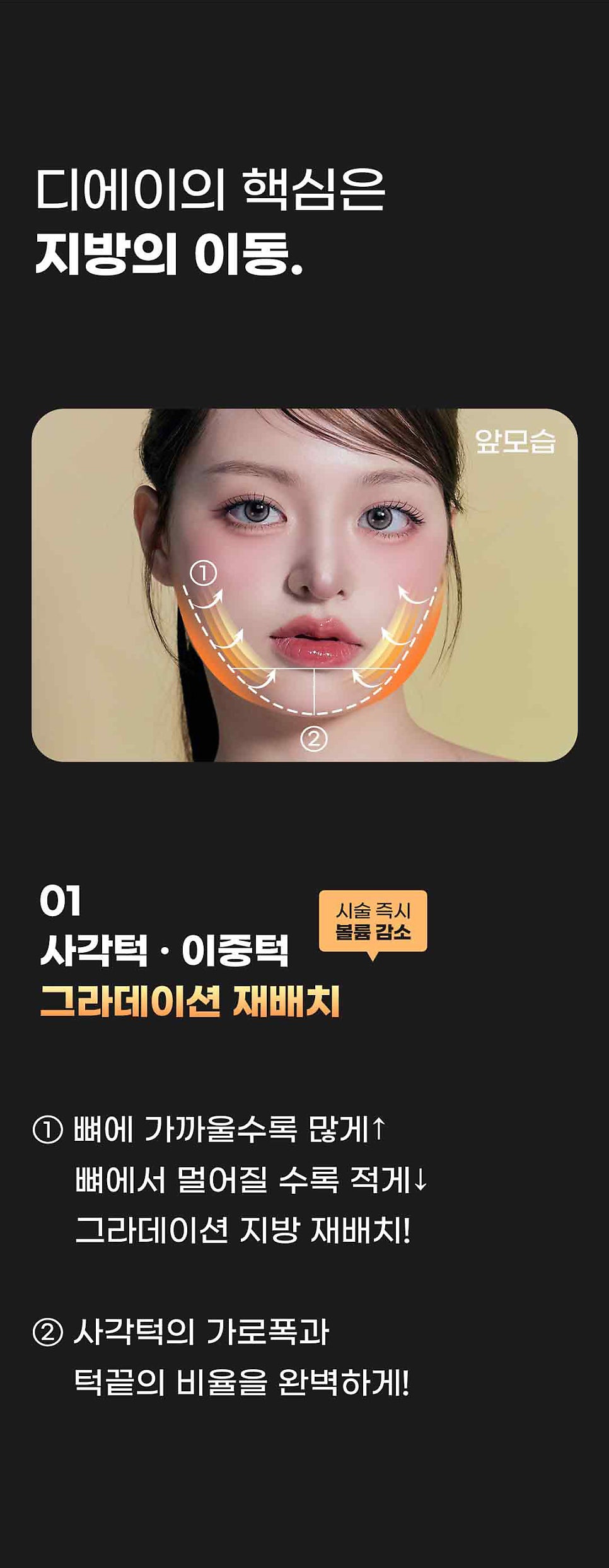 뼈깎기 대신 디에이 연조직윤곽술 관련 이미지 3