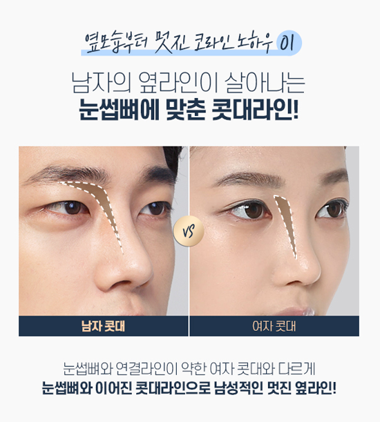 DA FOR MAN, 디에이성형외과 남자 코성형 관련 이미지 7