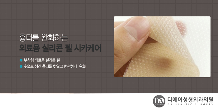 수술 전 내 가슴에 예쁜 보형물 미리 체크해보기 관련 이미지 16