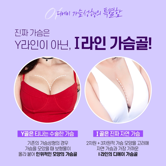 가슴성형 시작은 보형물 선택에서부터! 보형물 종류와 주의사항 관련 이미지 10
