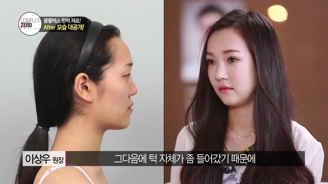 콤플렉스제로 7화 인형미모 한희수 관련 이미지 17