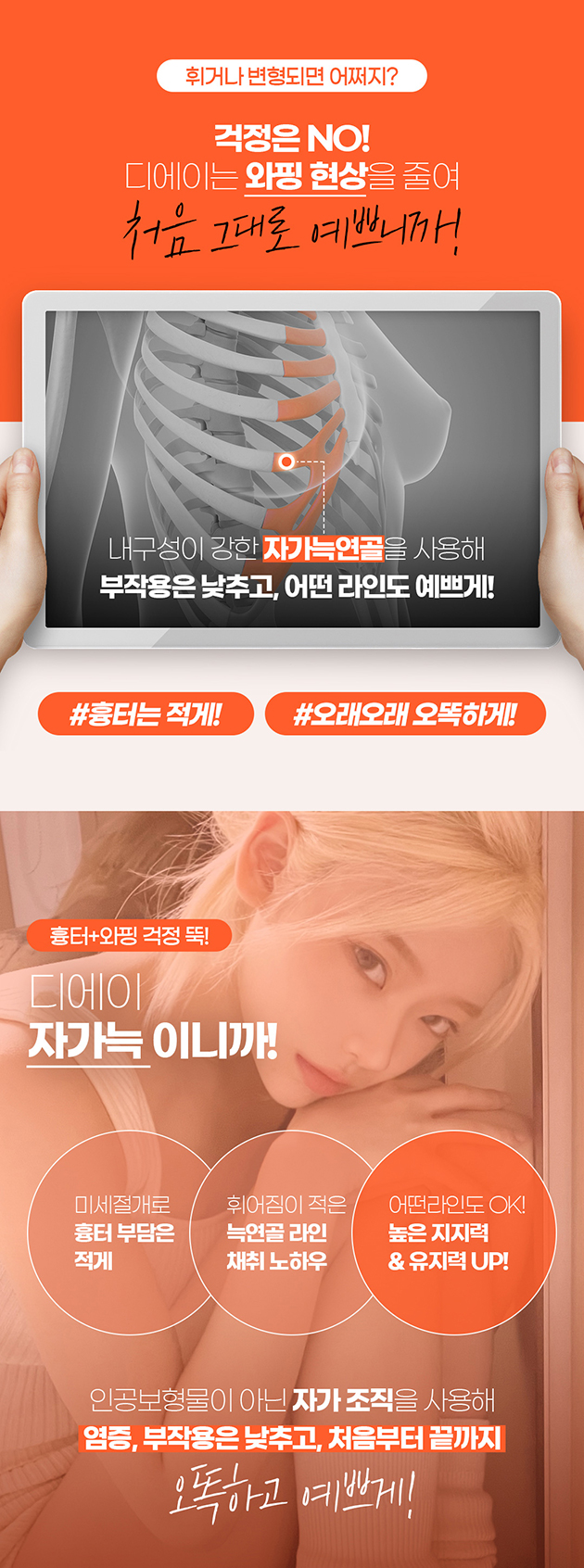 오래도록 오똑하게 자가늑코성형 관련 이미지 4