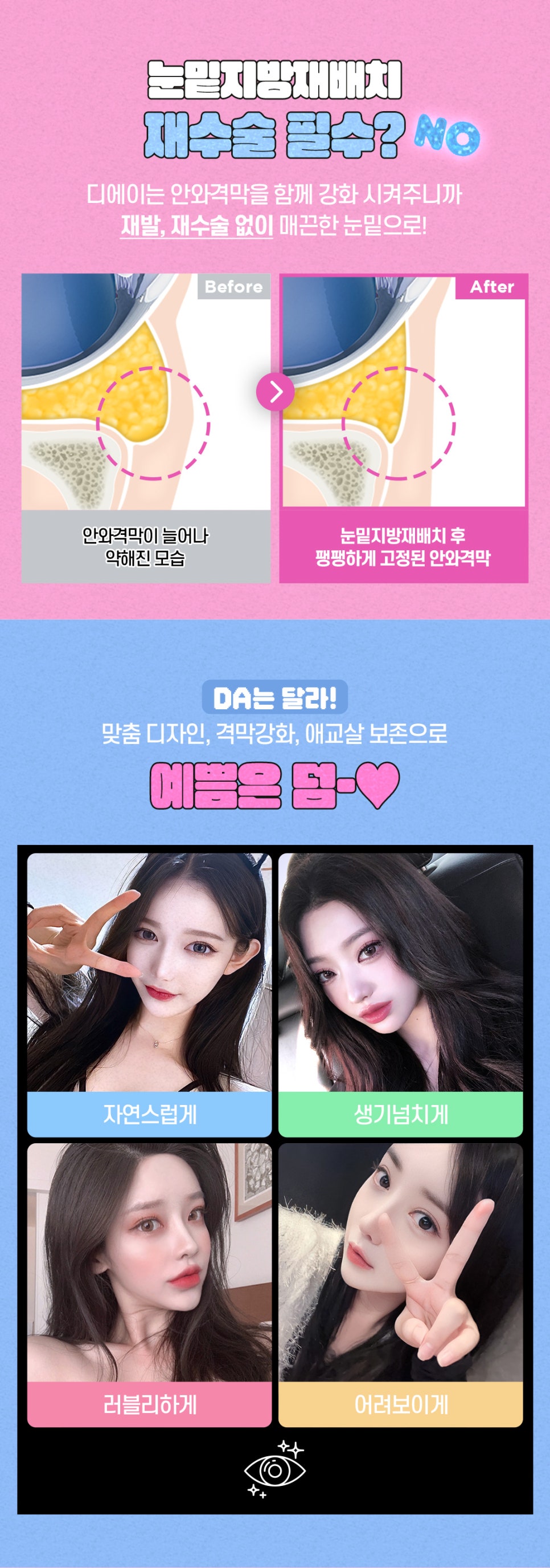 강남역 눈밑지방재배치 잘 하고 합리적인 곳은? 관련 이미지 5