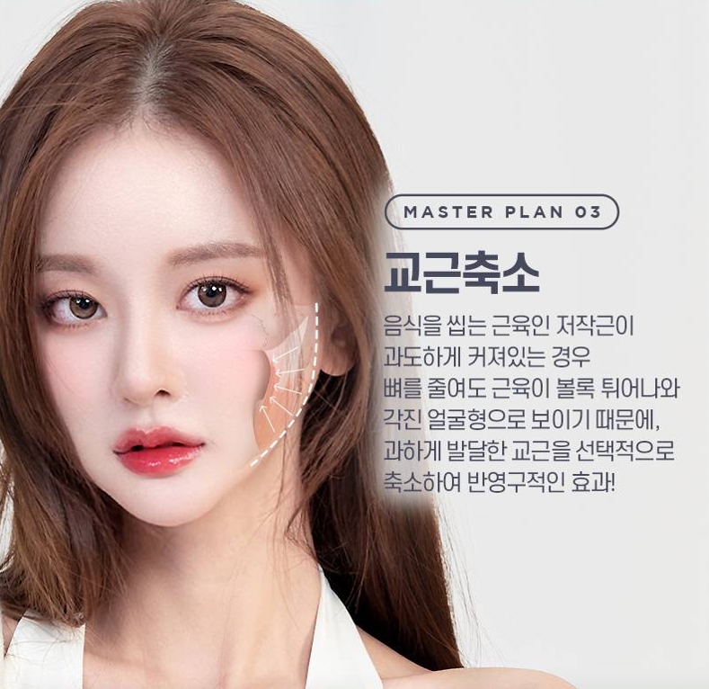 사각턱수술 비용보다 중요한 선택 기준은? 관련 이미지 5