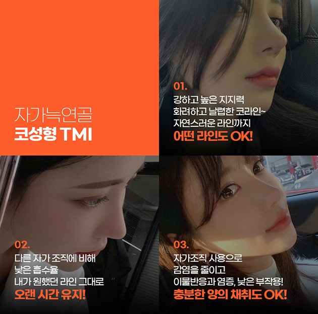 오래도록 오똑하게 자가늑코성형 관련 이미지 3