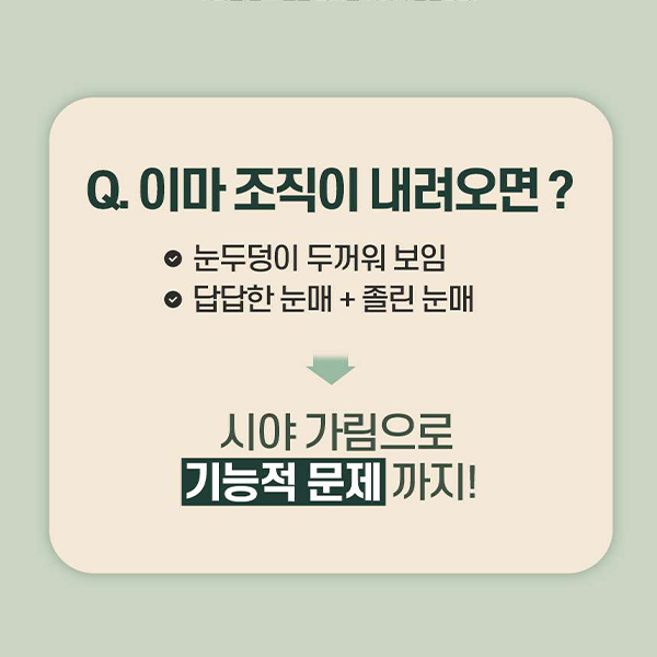 이마주름과 눈처짐을 동시에 개선, 수직 이마거상 관련 이미지 5