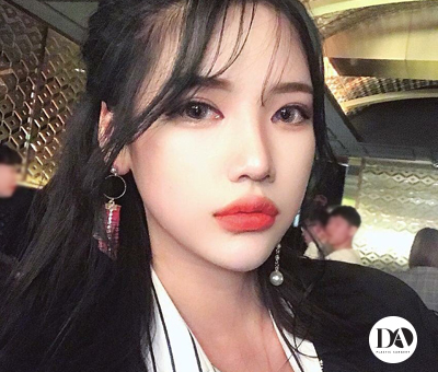 디에이성형외과 눈성형, 예쁘면DA야 관련 이미지 2