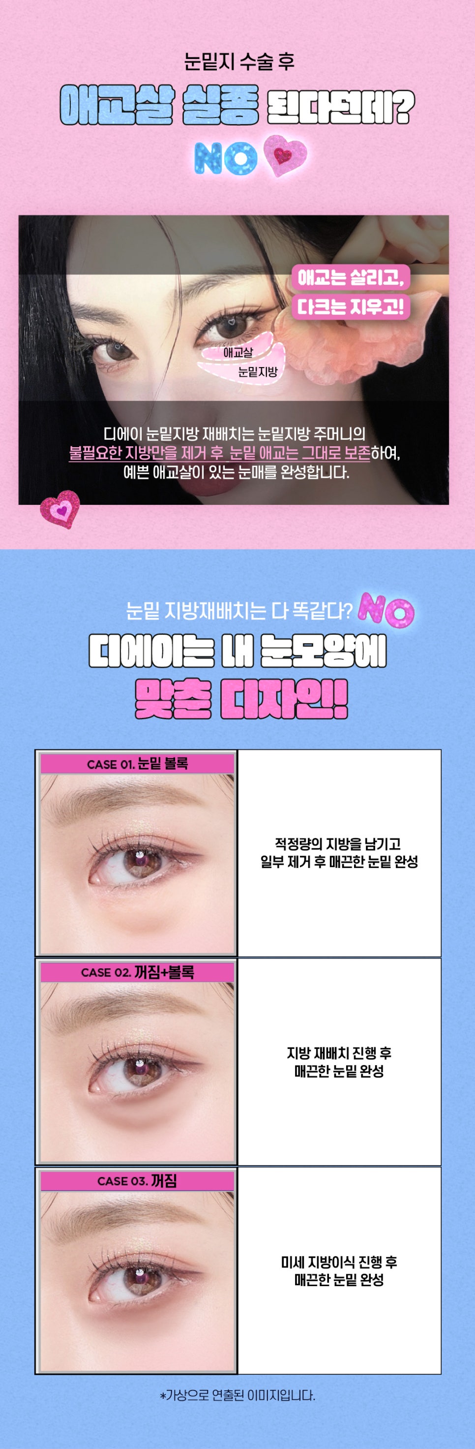 강남역 눈밑지방재배치 잘 하고 합리적인 곳은? 관련 이미지 4
