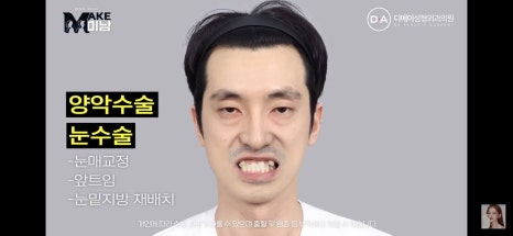 디에이성형외과 | 맥미남 시한폭탄내남자 개인인터뷰 근황 느낀점 관련 이미지 38