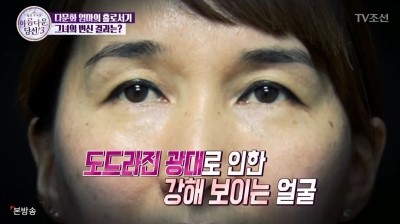 아름다운당신3 지나라씨와의 숨겨진 뒷이야기 공개 with 디에이성형외과 관련 이미지 9