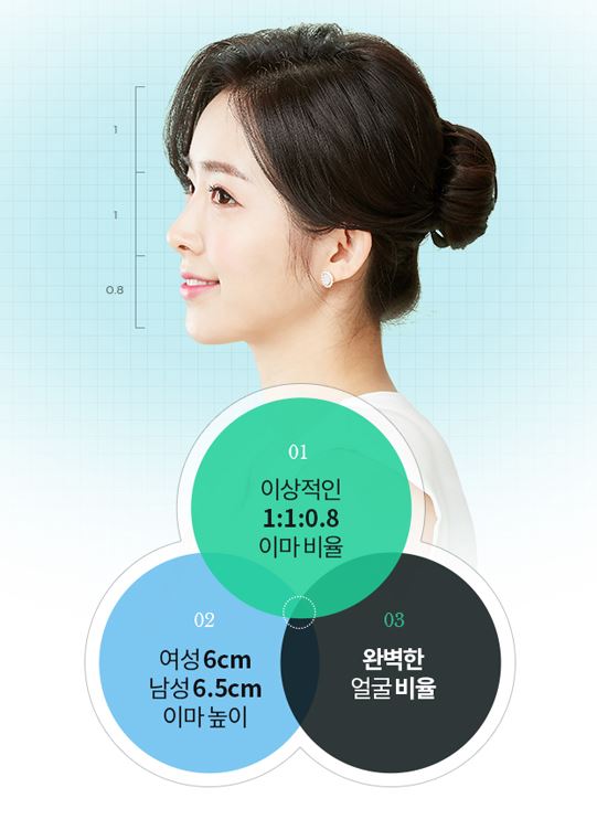 디에이성형외과 이마축소술, 작아보이는 얼굴 효과! 관련 이미지 3