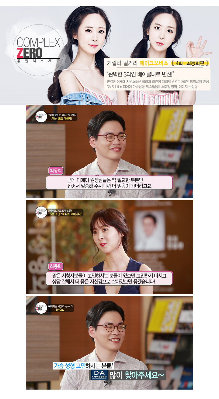 디에이성형외과 콤플렉스제로 S라인 베이글녀 최동희 관련 이미지 8