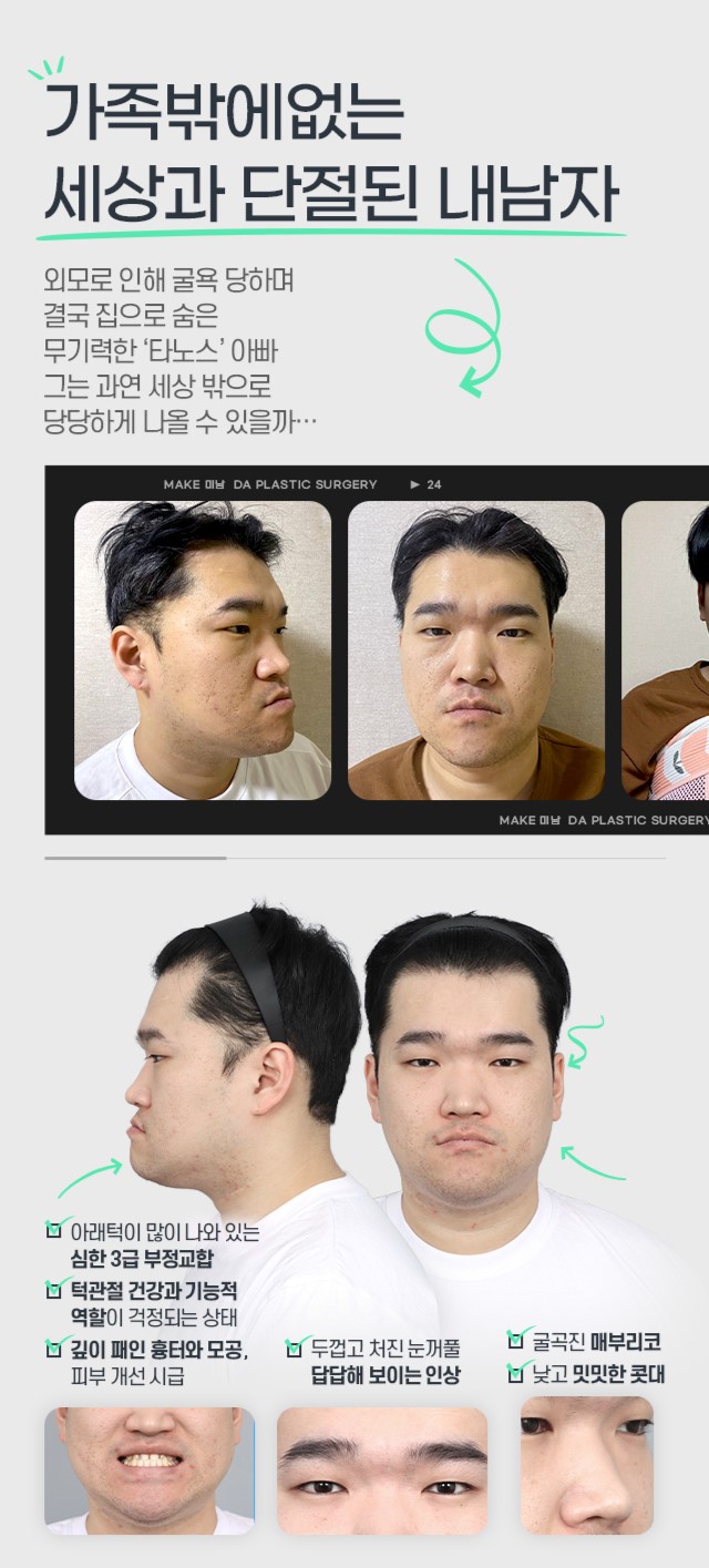 '맥미남' 새로운에피소드 야수내남자 솔루션 전후 모습 관련 이미지 2