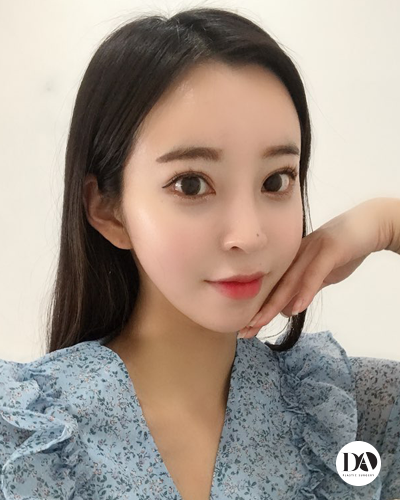 오차가 만드는 큰 차이, 디에이 양악수술 관련 이미지 5