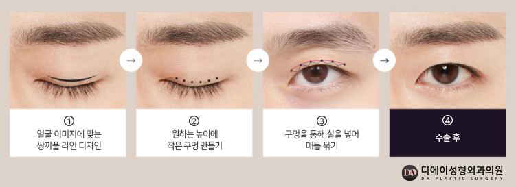 자연스러운 남자성형을 원한다면 관련 이미지 4