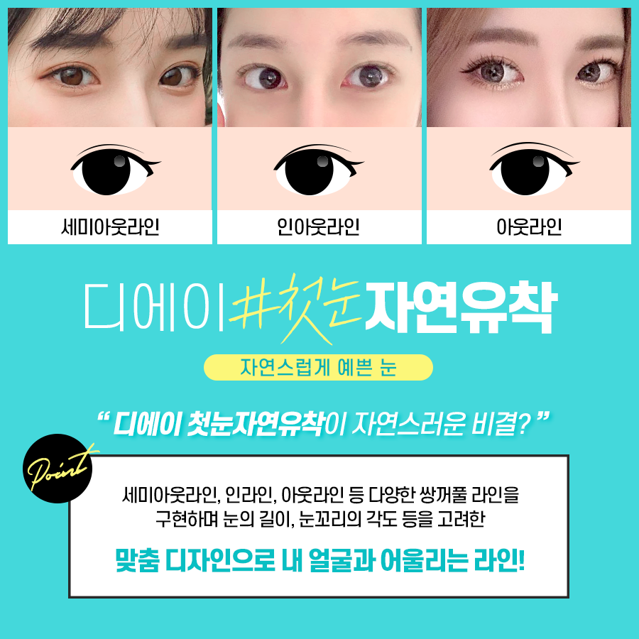 이미지에 맞게 라인 조절이 가능한 눈성형은? 관련 이미지 5