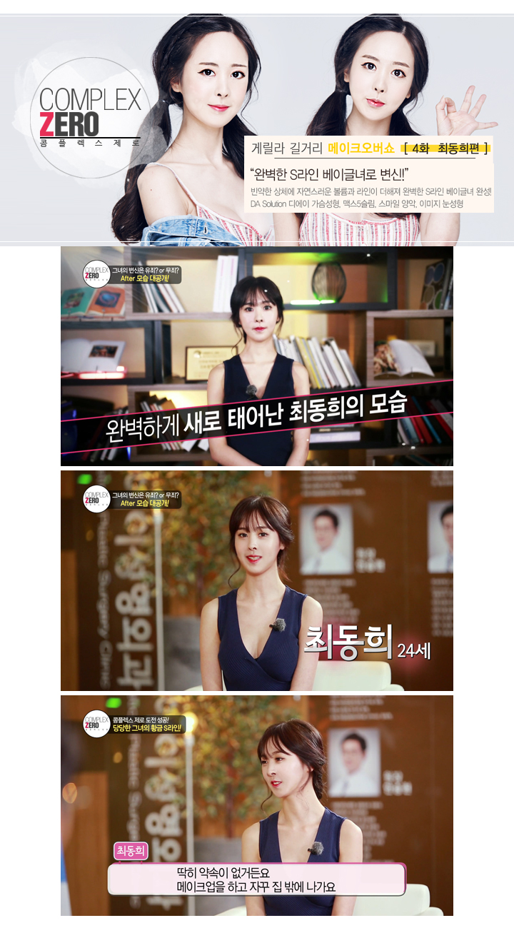 디에이성형외과 콤플렉스제로 S라인 베이글녀 최동희 관련 이미지 7