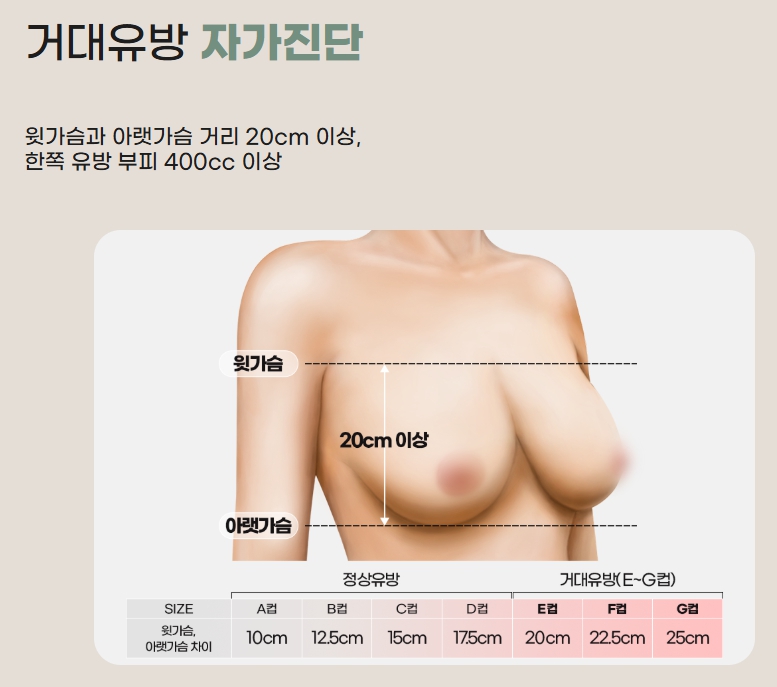 5 Things to Check Before Considering Breast Reduction Surgery Costs image 4