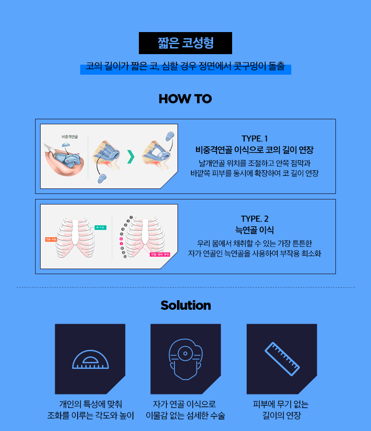 세련된 인상을 만드는 남자 코 성형 BEST 3 관련 이미지 6