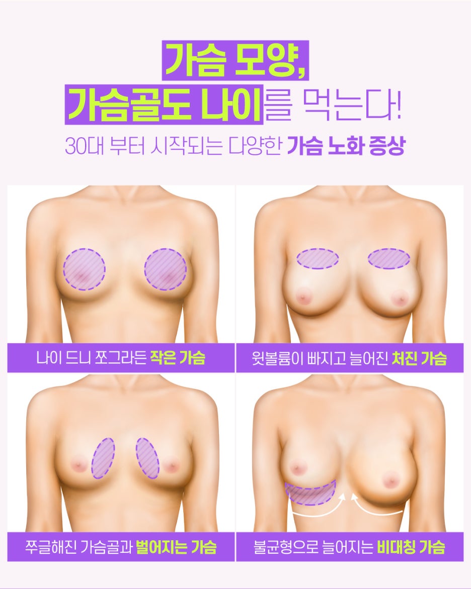 처진가슴리프팅 아름답고 자연스럽게 관련 이미지 6