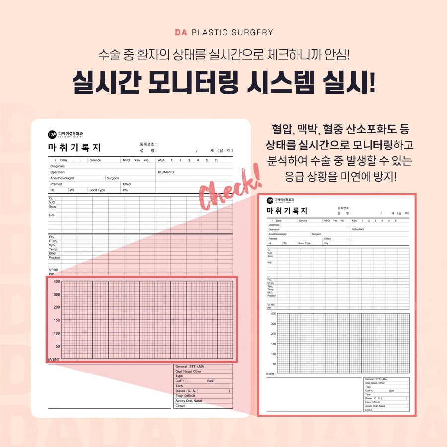 코성형, 개별 맞춤 수술을 위해 알아야 할 것 관련 이미지 10