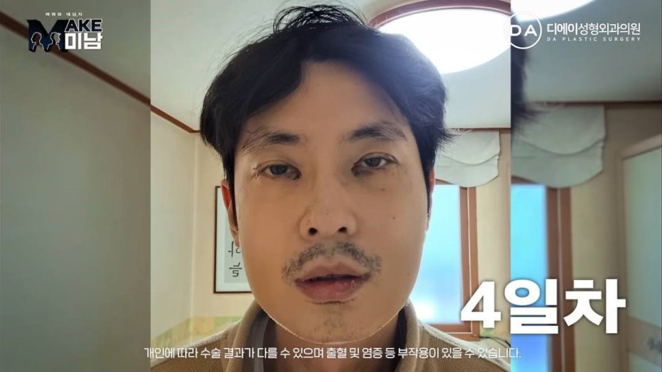 무엇이든물어보살 홍민기 성형 맥미남 후기 관련 이미지 5