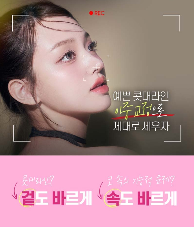 비염미용코수술, 코막힘과 코 모양을 함께 고려하려면 관련 이미지 2