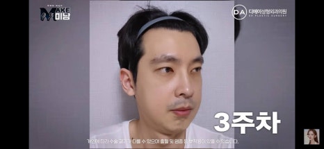 디에이성형외과 | 맥미남 시한폭탄내남자 개인인터뷰 근황 느낀점 관련 이미지 25