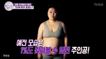 아름다운당신3 최선익 X DA성형외과 비하인드 컷 관련 이미지 11