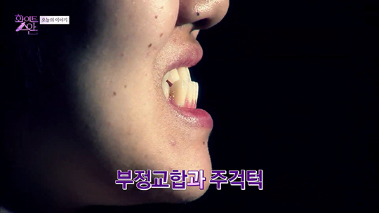 [DA성형외과] 화이트스완 5회 메이크오버 주인공 배경하 관련 이미지 3