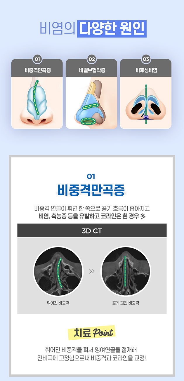 남자 기능코 수술 제대로 알고해야 관련 이미지 6