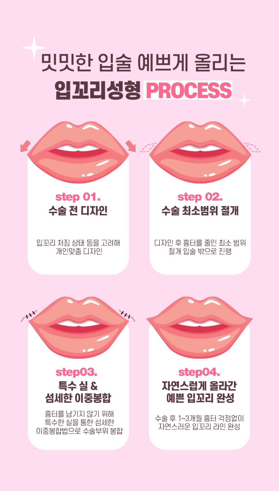 입꼬리성형으로 남심저격 인상되기 관련 이미지 7